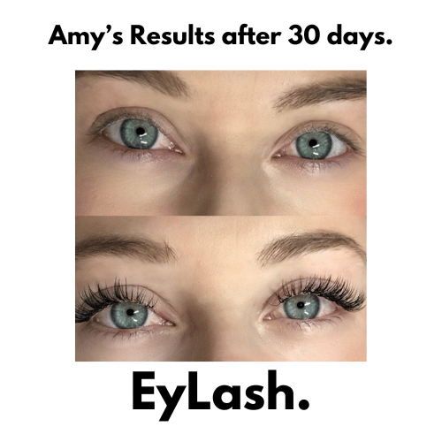 EyLash Growth Serum results after 30 days - Amy