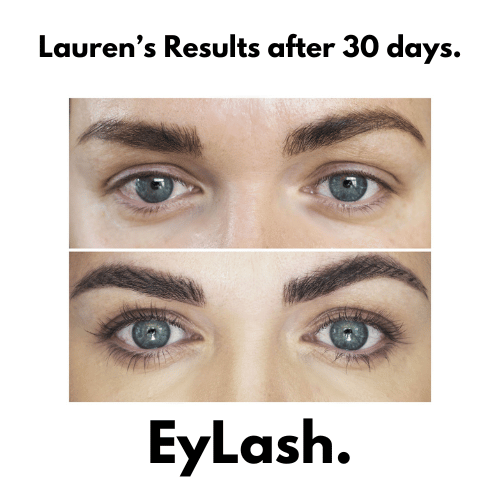 EyLash Growth Serum results after 30 days - Lauren