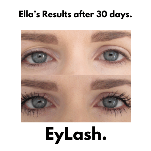 EyLash Growth Serum results after 30 days - Ella